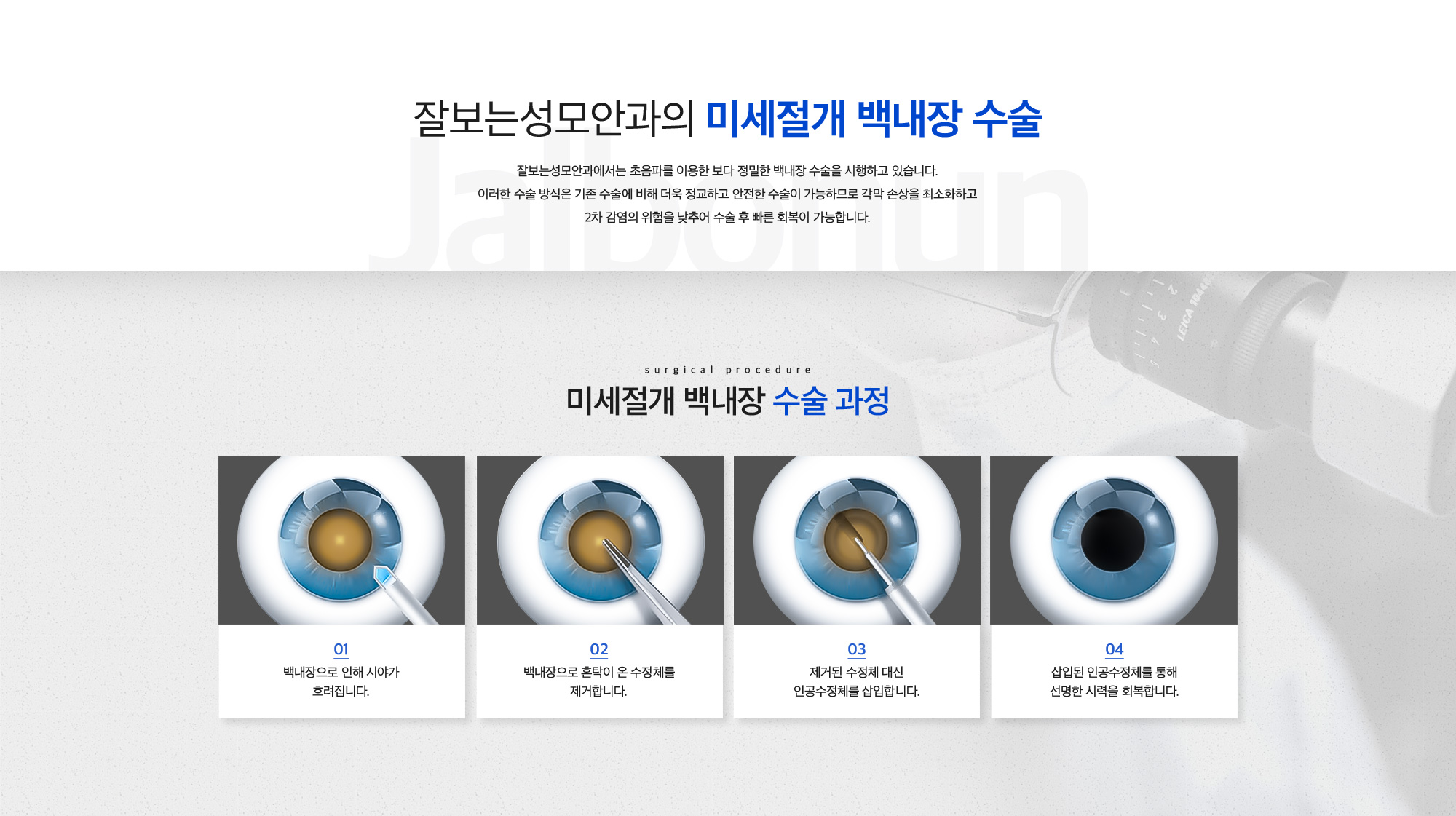 백내장수술