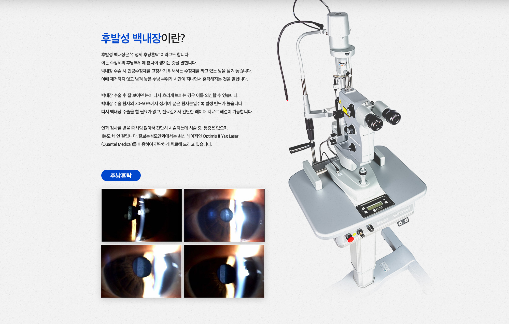 후발성 백내장 클리닉
