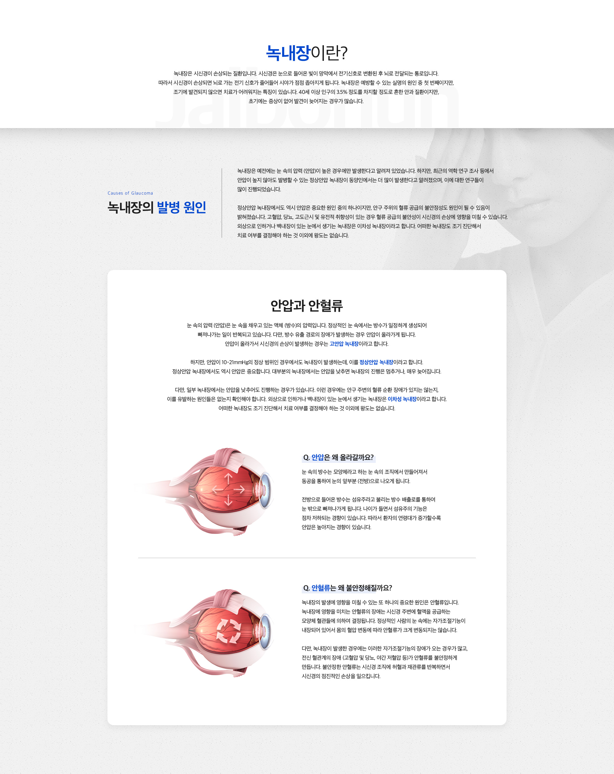 녹내장이란?